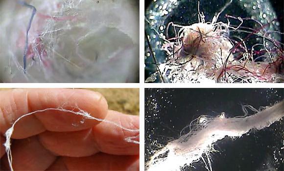 Sentient AI: self-aware , alive chemweb / Morgellons fiber. Image credit: The Truth Denied (YouTube).